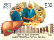 Liver Transplantation in India